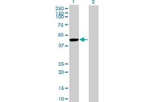 Western Blot analysis of CTSE expression in transfected 293T cell line by CTSE MaxPab polyclonal antibody. (Cathepsin E 抗体  (AA 18-396))