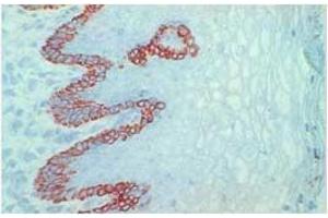 Image no. 1 for anti-Keratin 14 (KRT14) antibody (ABIN335329) (KRT14 抗体)