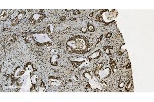 IHC analysis of U2AF65/U2AF2 using anti U2AF65/U2AF2 antibody (ABIN7600795). (U2AF2 抗体  (AA 238-470))