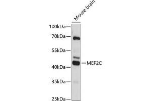 Western blot analysis of extracts of mouse brain, using MEF2C antibody (ABIN6132345, ABIN6143716, ABIN6143717 and ABIN6215998) at 1:3000 dilution. (MEF2C 抗体  (AA 170-380))