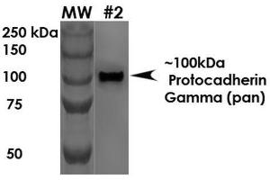 Western Blot analysis of Rat Brain Membrane showing detection of ~100 kDa Protocadherin Gamma protein using Mouse Anti-Protocadherin Gamma Monoclonal Antibody, Clone S159-5 . (Protocadherin gamma 抗体  (AA 808-931) (APC))