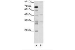Image no. 1 for anti-Forkhead Box N2 (FOXN2) (C-Term) antibody (ABIN307420) (FOXN2 抗体  (C-Term))