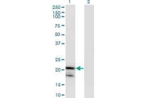 Western Blotting (WB) image for anti-Interleukin 1 Receptor Antagonist (IL1RN) (AA 1-160) antibody (ABIN793045)