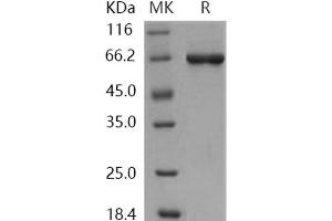 Western Blotting (WB) image for serine/threonine Kinase 40 (STK40) protein (GST tag,His tag) (ABIN7197936)