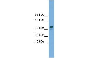 WB Suggested Anti-GANAB Antibody Titration: 0. (GANAB 抗体  (Middle Region))