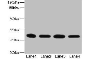 Western blot All lanes: EIF3K antibody at 1. (EIF3K 抗体  (AA 1-218))
