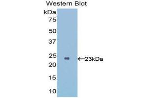 Western Blotting (WB) image for anti-Interleukin 1 Receptor-Like 1 (IL1RL1) (AA 162-349) antibody (ABIN1176679) (IL1RL1 抗体  (AA 162-349))
