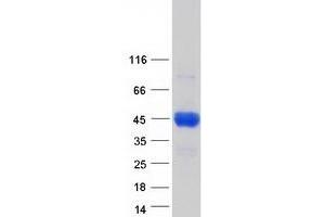 Western Blotting (WB) image for Complement Component 4 Binding Protein, beta (C4BPB) (Transcript Variant 1) protein (Myc-DYKDDDDK Tag) (ABIN2715518)
