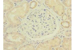 Immunohistochemistry of paraffin-embedded human kidney tissue using ABIN7175065 at dilution of 1:100 (C11orf1 抗体  (AA 33-150))