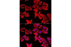 Immunofluorescence analysis of U20S cell using THRSP antibody. (THRSP 抗体)