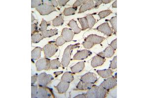 DDX60L Antibody (C-term) (ABIN655540 and ABIN2845051) immunohistochemistry analysis in formalin fixed and paraffin embedded human skeletal muscle followed by peroxidase conjugation of the secondary antibody and DAB staining. (DDX60L 抗体  (C-Term))