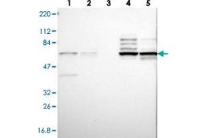 Western blot analysis of Lane 1: RT-4, Lane 2: U-251 MG, Lane 3: Human Plasma, Lane 4: Liver, Lane 5: Tonsil with CNOT4 polyclonal antibody . (CNOT4 抗体)
