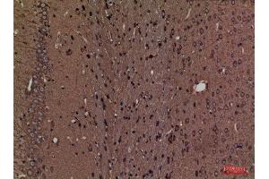 Immunohistochemistry (IHC) image for anti-serine Palmitoyltransferase, Long Chain Base Subunit 1 (SPTLC1) (C-Term) antibody (ABIN3187765)