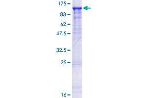 Oligophrenin 1 Protein (OPHN1) (AA 1-802) (GST tag)
