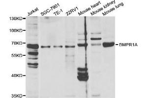 Western blot analysis of extracts of various cell lines, using BMPR1A antibody. (BMPR1A 抗体  (AA 24-200))