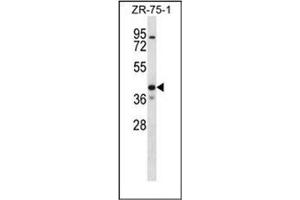 Western blot analysis of KCNK1 Antibody (C-term) in ZR-75-1 cell line lysates (35ug/lane). (KCNK1 抗体  (C-Term))