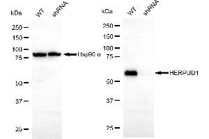 Western blotting analysis using HERPUD1 antibody (ABIN7798998).