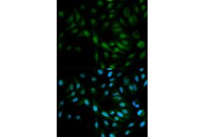 Immunofluorescence analysis of MCF-7 cells using MAPK7 antibody. (MAPK7 抗体)