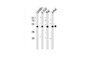 All lanes : Anti-ETV6 Antibody (N-term) at 1:2000 dilution Lane 1: U266B1 whole cell lysate Lane 2: U-2OS whole cell lysate Lane 3: Raji whole cell lysate Lane 4: Jurkat whole cell lysate Lysates/proteins at 20 μg per lane. (ETV6 抗体  (N-Term))