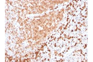 Formalin-fixed, paraffin-embedded human Tonsil stained with TCL1 Recombinant Rabbit Monoclonal Antibody (TCL1/2747R). (Recombinant TCL1A 抗体  (AA 2-109))