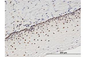 Immunoperoxidase of monoclonal antibody to STRADA on formalin-fixed paraffin-embedded human uterine cervix. (STRADA 抗体  (AA 251-346))