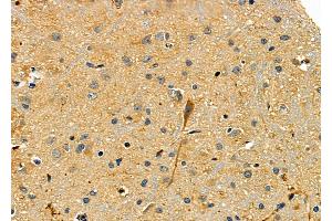 ABIN6265196 and ABIN6277869 at 1/100 staining Rat brain tissue by IHC-P. (SMURF2 抗体  (Internal Region))