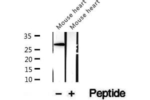 Western blot analysis of extracts of mouse heart tissue, using CHMP4B antibody. (CHMP4B 抗体  (N-Term))