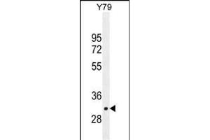 LRRC46 Antibody (N-term) (ABIN655306 and ABIN2844888) western blot analysis in Y79 cell line lysates (35 μg/lane). (LRRC46 抗体  (N-Term))