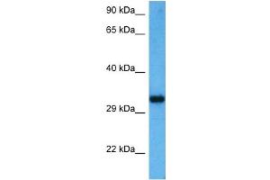 Western Blotting (WB) image for anti-SRY (Sex Determining Region Y)-Box 4 (SOX4) (N-Term) antibody (ABIN2780469)