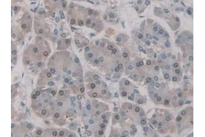 Detection of UNG in Human Pancreas Tissue using Polyclonal Antibody to Uracil DNA Glycosylase (UNG) (UNG 抗体  (AA 1-313))