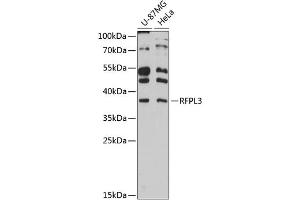 Western blot analysis of extracts of various cell lines, using RFPL3 antibody (ABIN6130677, ABIN6146893, ABIN6146894 and ABIN6215966) at 1:3000 dilution. (RFPL3 抗体  (AA 1-288))