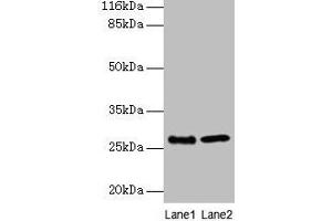 Western blot All lanes: EBP antibody at 2 μg/mL Lane 1: A549 whole cell lysate Lane 2: 293T whole cell lysate Secondary Goat polyclonal to rabbit IgG at 1/10000 dilution Predicted band size: 27 kDa Observed band size: 27 kDa (EBP 抗体  (AA 2-230))