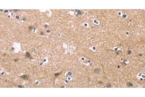 Immunohistochemistry of paraffin-embedded Human brain tissue using CDC25B Polyclonal Antibody at dilution 1:45 (CDC25B 抗体)