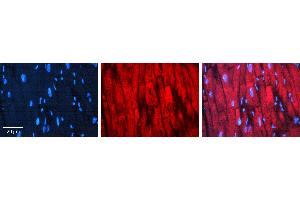 Rabbit Anti-CDC34 Antibody  AV Formalin Fixed Paraffin Embedded Tissue: Human heart Tissue Observed Staining: Cytoplasmic near intercalated discs Primary Antibody Concentration: 1:100 Other Working Concentrations: N/A Secondary Antibody: Donkey anti-Rabbit-Cy3 Secondary Antibody Concentration: 1:200 Magnification: 20X Exposure Time: 0. (CDC34 抗体  (Middle Region))