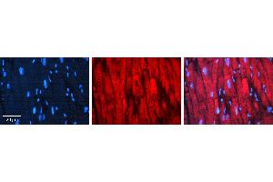 Rabbit Anti-CDC34 Antibody  AV Formalin Fixed Paraffin Embedded Tissue: Human heart Tissue Observed Staining: Cytoplasmic near intercalated discs Primary Antibody Concentration: 1:100 Other Working Concentrations: N/A Secondary Antibody: Donkey anti-Rabbit-Cy3 Secondary Antibody Concentration: 1:200 Magnification: 20X Exposure Time: 0. (CDC34 抗体  (Middle Region))