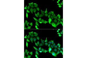 Immunofluorescence analysis of A549 cell using GRK6 antibody.