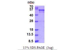 Bromodomain Containing 3 (BRD3) (AA 1-416) protein (His tag)