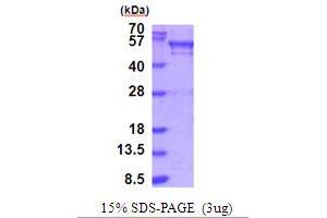 SDS-PAGE (SDS) image for Bromodomain Containing 3 (BRD3) (AA 1-416) protein (His tag) (ABIN5854008) (BRD3 Protein (AA 1-416) (His tag))