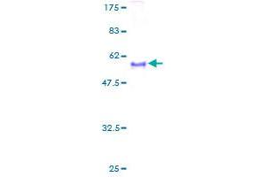Image no. 1 for Bone Marrow Stromal Cell Antigen 1 (BST1) (AA 1-318) protein (GST tag) (ABIN1346911)
