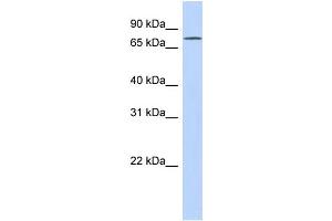 WB Suggested Anti-FLJ20433 Antibody Titration: 0. (EXD3 抗体  (N-Term))