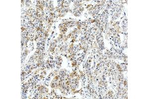 IHC analysis of Fibrinogen Beta Chain/FGB using anti-Fibrinogen Beta Chain/FGB antibody (ABIN4886579).
