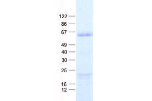 Validation with Western Blot (ACRBP Protein (His tag))