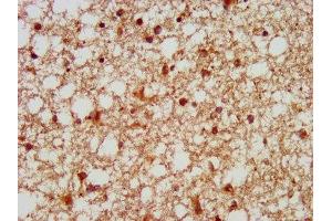 IHC image of ABIN7153781 diluted at 1:100 and staining in paraffin-embedded human brain tissue performed on a Leica BondTM system. (GTF3C5 抗体  (AA 305-448))