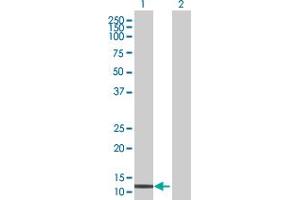 Lane 1: ID1 transfected lysate ( 17. (ID1 293T Cell Transient Overexpression Lysate(Denatured))