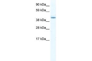 DDX49 antibody used at 2. (DDX49 抗体)