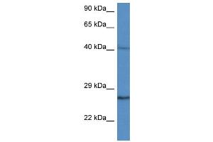 WB Suggested Anti-CCS AntibodyTitration: 1. (Superoxide dismutase copper chaperone 抗体  (C-Term))