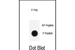 Dot blot analysis of anti-Phospho-KLF4- Antibody (ABIN390035 and ABIN2839785) on nitrocellulose membrane.