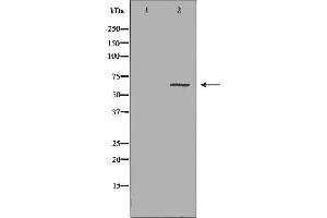 Western blot analysis of Hepg2 whole cell lysates, using CES1 Antibody. (CES1 抗体  (C-Term))