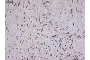 Immunohistochemical staining of paraffin-embedded kidney using anti-STAT3 (ABIN2452542) mouse monoclonal antibody. (STAT3 抗体  (AA 154-175))