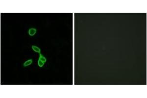Immunofluorescence analysis of LOVO cells, using GALR1 Antibody. (Galanin Receptor 1 抗体  (AA 161-210))